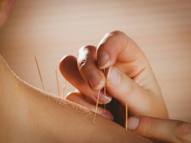 The best acupuncturists in NYC